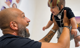 Plagiocephaly Helmet