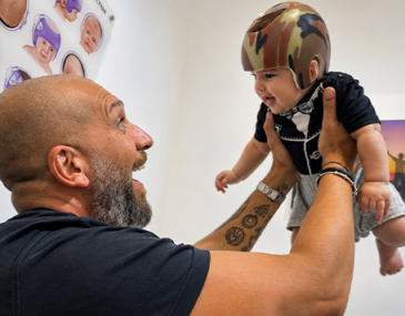 Plagiocephaly Helmet