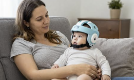 Plagiocephaly vs Craniosynostosis