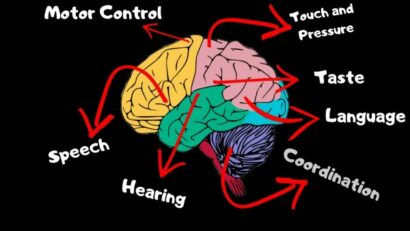 Neurorehablitation
