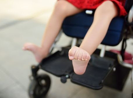 pediatric prosthetics