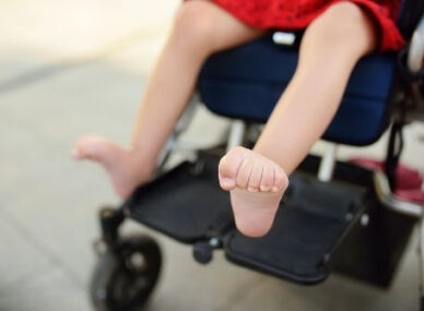 pediatric prosthetics