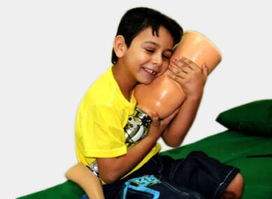 children's prosthetics