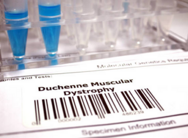 Duchenne Muscular Dystrophy