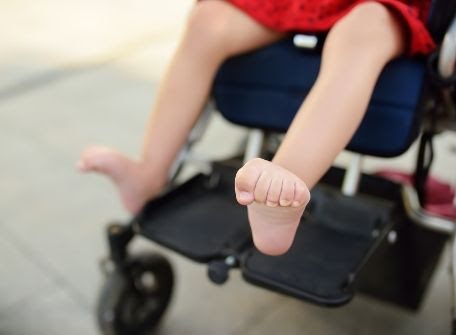 pediatric prosthetics