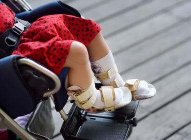 ankle foot orthosis,