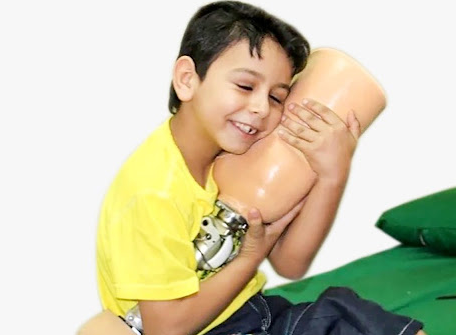 children's prosthetics