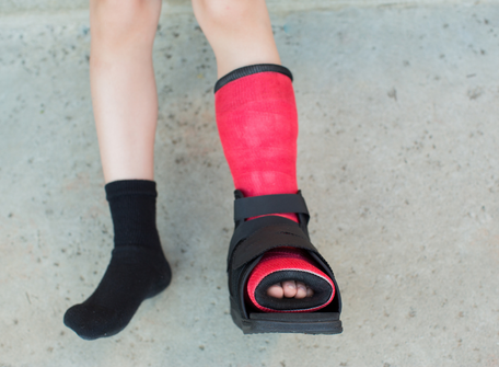Ankle Foot Orthotics with CP Hope AMC