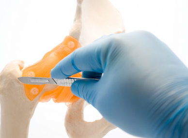 lump on child's shin bone Dubai