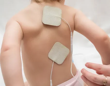 Electrical Stimulation for Children