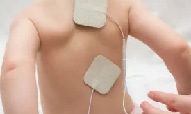 Electrical Stimulation for Children