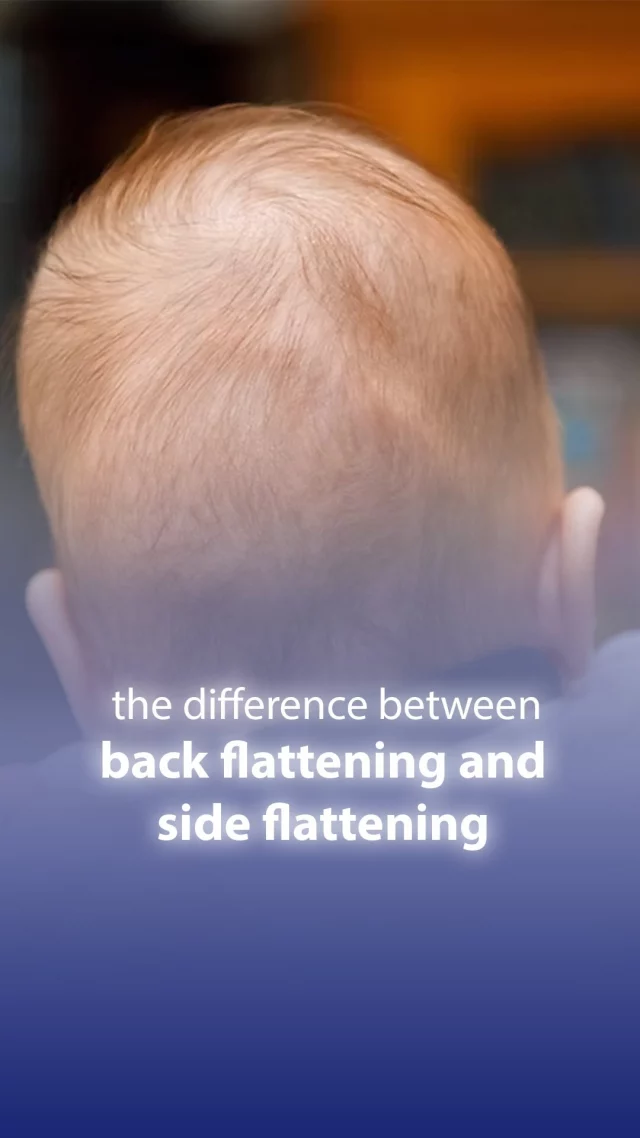 🤔✨ Do you know the difference between back flattening and side flattening? Each type has its own characteristics and effects on overall shape. Let’s explore this topic together! 💡🤔✨ هل تعرف الفرق بين تسطيح الظهر والتسطيح الجانبي؟ كل نوع له خصائصه وتأثيراته على الشكل العام. دعونا نستكشف هذا الموضوع معاً! 💡Book an appointment for your child today!
📲 +971-42703333
📲 +971-529997075
📧 info@hope-amc.com#HopeAmc #HopeAmcDubai #HeadFlattening #UnderstandingDifferences #peaditrictherapy #specialneeds #pediatrictherapycenterdubai #peopleofdeterminationdubai #pediatricphysiotherapydubai #pediatricoccupationaltherapydubai #pediatricspeechtherapydubai